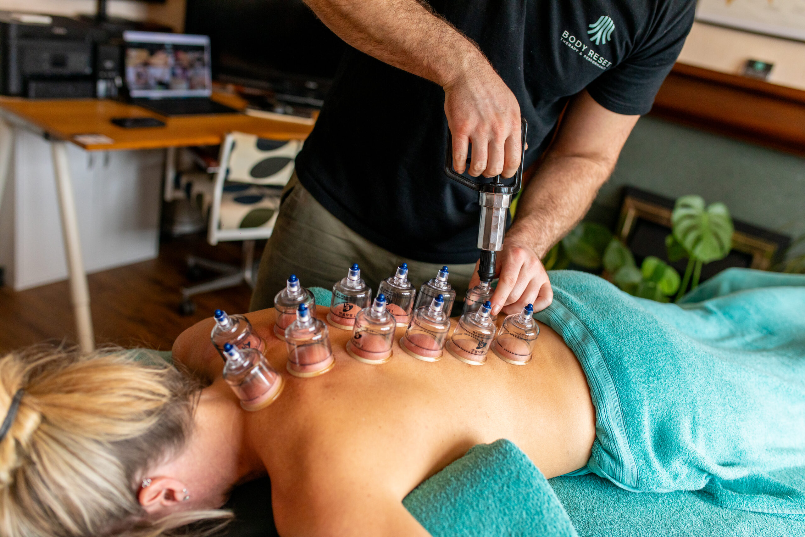 DRY CUPPING massage therapy mansfield